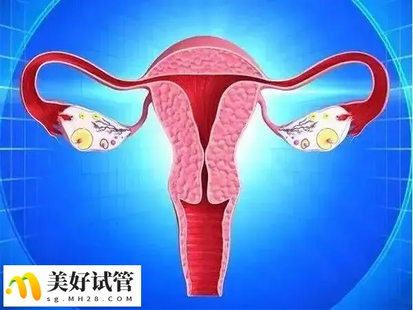 子宫内膜异位症会影响试管成功率
