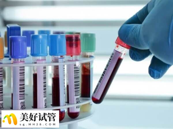 全麻手术前要抽血查传染病