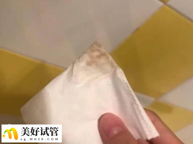 取卵前要进行分泌物检查